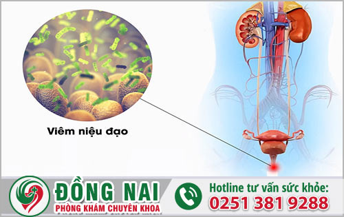 6 yếu tố gây ra viêm đường tiết niệu ở nữ đáng quan tâm