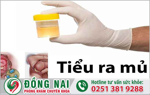 Ảnh hưởng không ngờ khi đi tiểu ra mủ