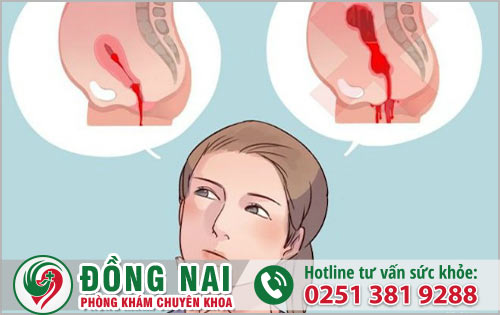 Hiện tượng băng huyết sau sinh 1 tháng là bất thường?