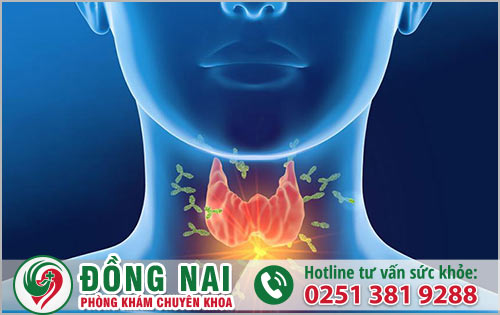 Những triệu chứng bệnh cường giáp