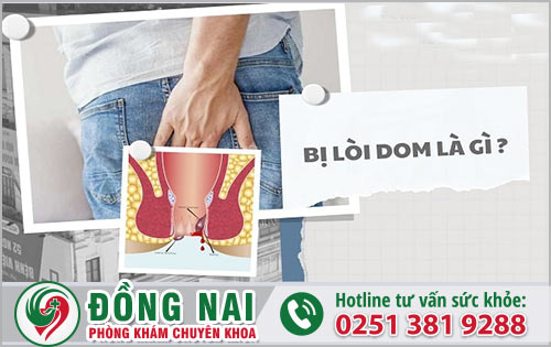 Mắc phải bệnh lòi dom là gì?