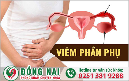 Biểu hiện của tình trạng viêm phần phụ là gì?