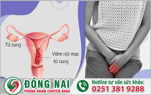 Viêm nội mạc có gây ảnh hưởng gì không?