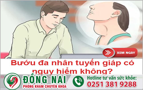 Bướu đa nhân tuyến giáp có nguy hiểm không?