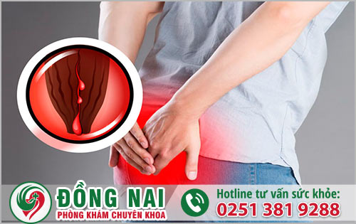 Nguyên nhân hậu môn tiết ra chất nhầy