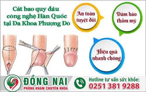 Cắt bao quy đầu bằng kỹ thuật hiện đại tại Đồng Nai