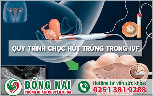 Quy trình chọc hút trứng