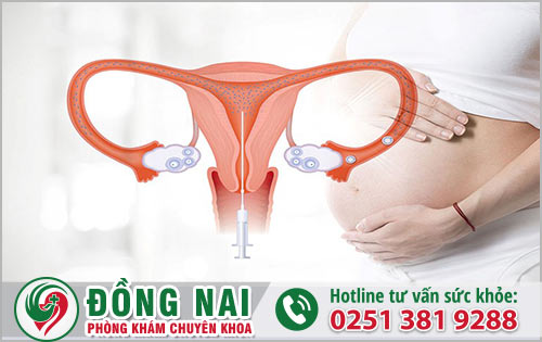 Chữa buồng trứng đa nang bằng OvaQ1