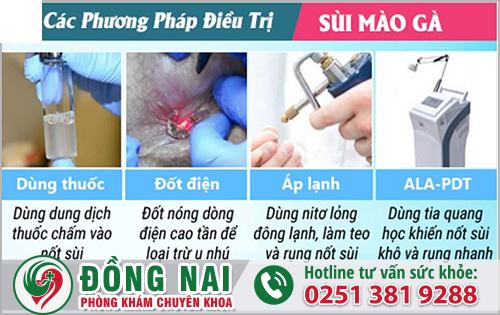 Nếu chưa quan hệ mà mắc phải sùi mào gà thì phải làm gì?