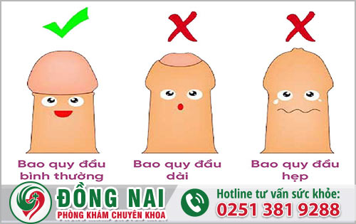 Chức năng quan hệ tình dục có bị giảm vì hẹp bao quy đầu không?