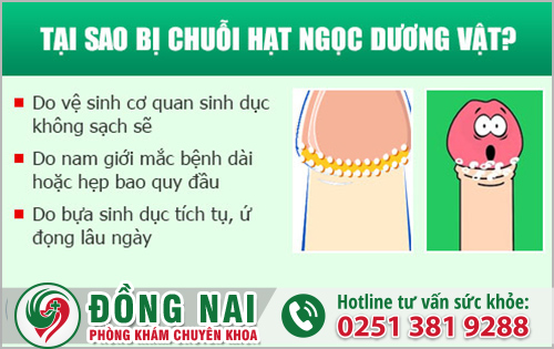 Nguyên nhân gây ra chuỗi hạt ngọc dương vật