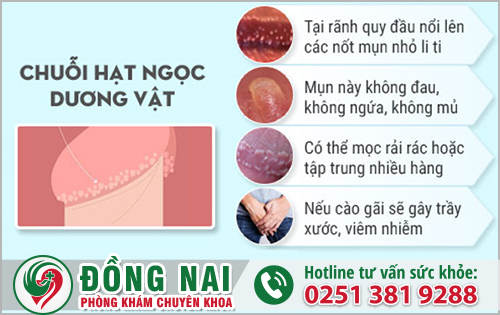 Chuỗi hạt ngọc dương vật là bệnh lý gì?