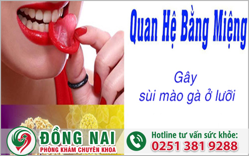 Nguyên nhân gây sùi mào gà dưới lưỡi