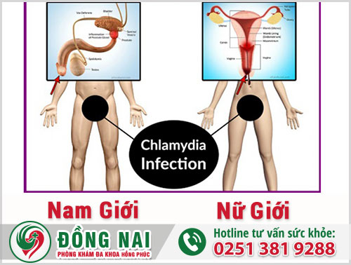 Dấu hiệu bệnh Chlamydia ở nam và nữ giới