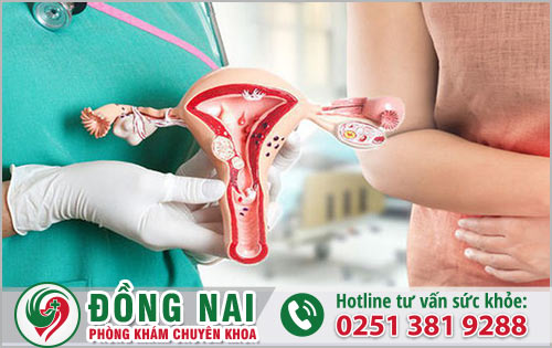 Địa chỉ khám chữa bệnh phụ khoa lạc nội mạc tử cung tại Đồng Nai?