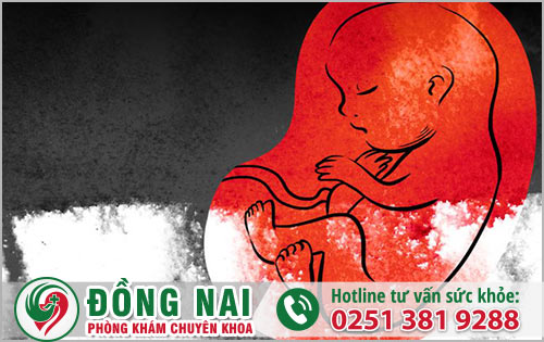 Địa chỉ phá thai an toàn với giá hợp lý tại Đồng Nai?