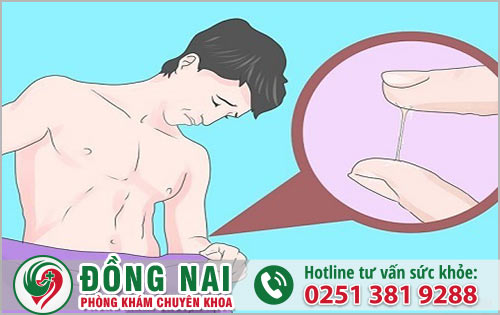 Dương vật chảy mủ trắng đục – Cảnh báo bệnh lý nguy hiểm