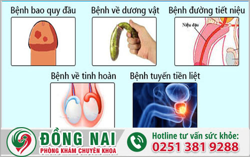 Khám dương vật ở đâu tại Đồng Nai hiệu quả có giá hợp lý?