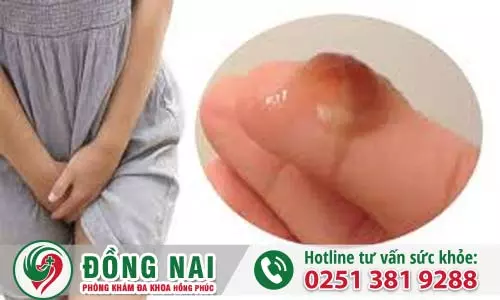 Khí hư màu nâu có nguy hiểm không, gồm những loại nào?