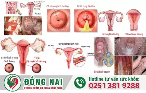 Khí hư màu xanh và những bí mật ít ai biết đến