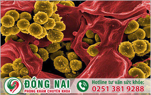 Khuẩn tụ cầu vàng là loại virus gì?