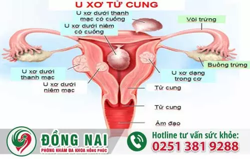 Kinh nguyệt không ra được có sao không?