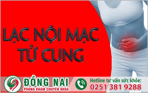 Lạc nội mạc tử cung nữ giới không nên chủ quan