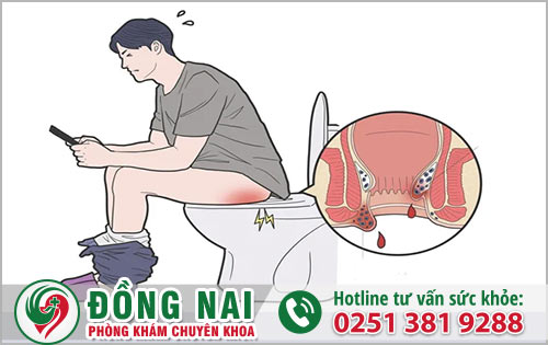 Mắc bệnh trĩ có nên ngâm nước muối không?