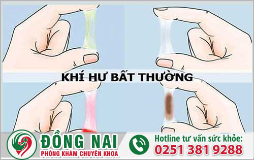 Khí hư bất thường là gì và các biểu hiện ra sao?