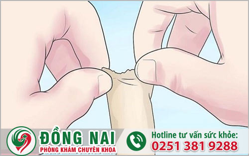 Nam giới bị dài bao quy đầu có nên tiến hành phẩu thuật hay không?