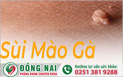 Nam giới bị sùi mào gà tại bao quy đầu nguy hiểm sức khỏe ra sao?