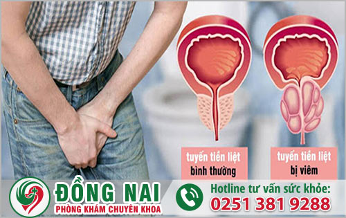 Nam giới chớ nên xem thường khi bị đau tuyến tiền liệt