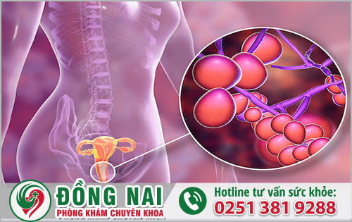 Nấm vùng kín dẫn đến các nguy hại nào tới nữ giới?