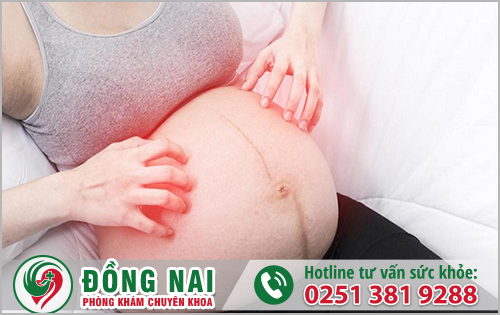 Hướng dẫn cách chữa ngứa bụng khi mang thai ở mẹ bầu