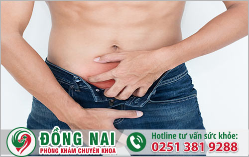 Ngứa dương vật kèm mùi hôi cảnh báo bệnh gì?