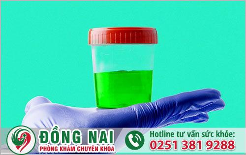 Nguyên nhân khiến nước tiểu có màu xanh