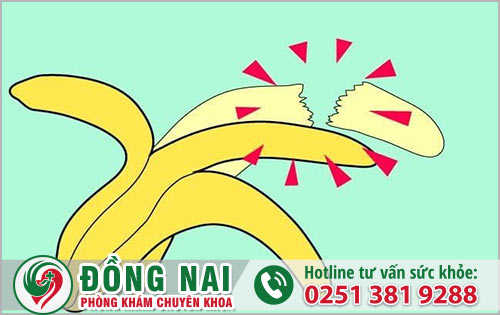 Nguyên nhân và triệu chứng vỡ hang vật nam giới