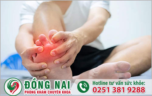 Nguyên nhân và triệu chứng của bệnh gout