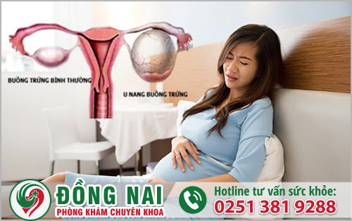 Nguyên nhân và triệu chứng của u nang buồng trứng khi mang thai