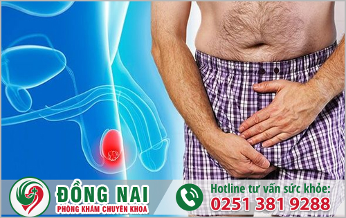 Ung thư tinh hoàn thường gây đau đớn, khó chịu, ảnh hưởng đến sức khỏe nam giới