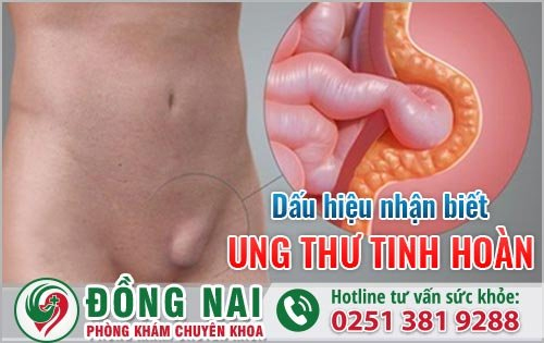 Nhận biết ung thư tinh hoàn là gì?