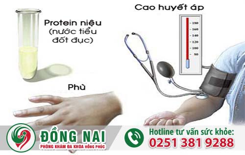 3 dấu hiệu nhiễm độc thai nghén mẹ bầu phải biết!