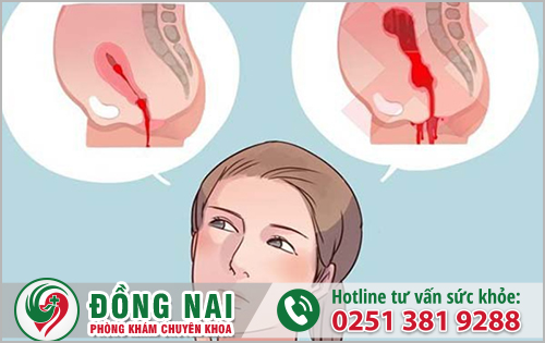 Triệu chứng nhiễm trùng tử cung sau sinh