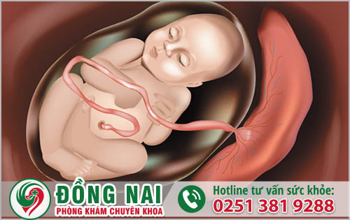 Những dạng nhau bám mặt sau mà bạn cần biết