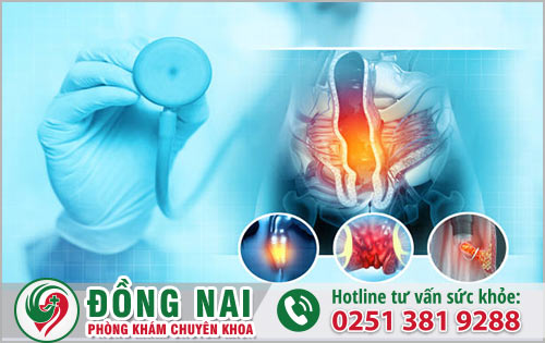 Những người bị bệnh trĩ có nội soi đại tràng được không?