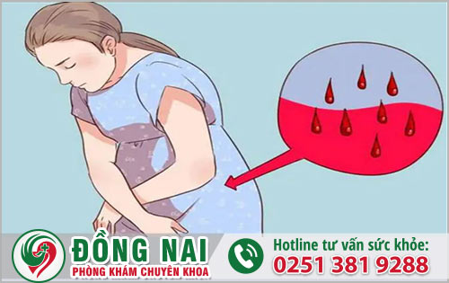 Nhiễm trùng hậu sản là vấn đề gì?