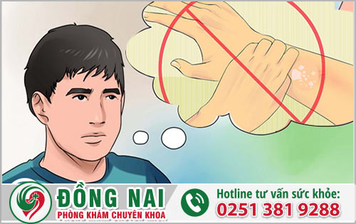 Những vị trí xuất hiện mề đay phổ biến