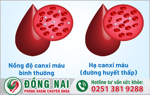 Những yếu tố nguyên nhân nào dẫn đến tuột canxi ở cơ thể người?