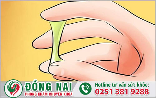 Nước vàng chảy ra ở hậu môn cảnh báo bệnh gì?