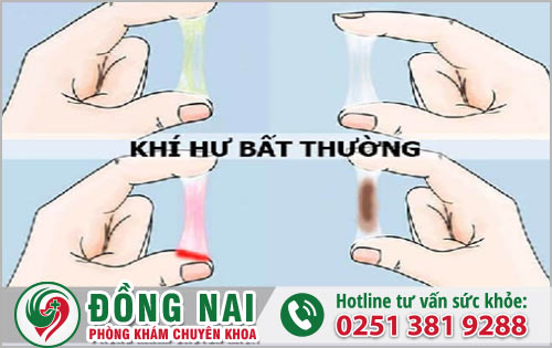 Phát giác khí hư có màu lạ ở nữ cảnh báo nhiều nguy hiểm